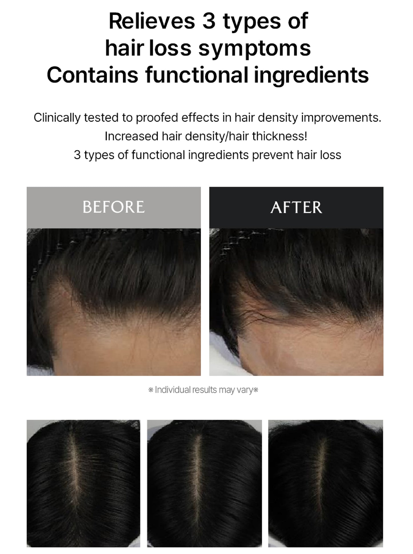 Lador Dermatical Scalp Tonic 120ml