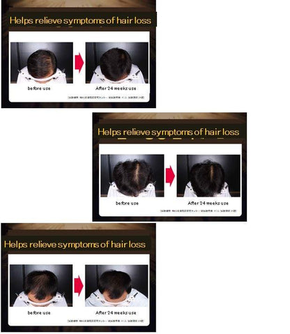 DAMOAE Therapy Hair Loss Tonic 100ml MaysonBeauty